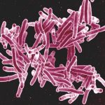 Bacteria ‘Mycobacterium tuberculosis’, responsable de la enfermedad.