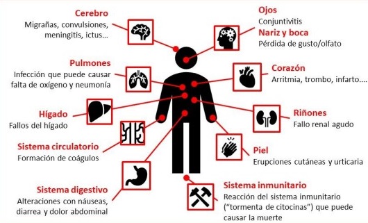 El SARS-CoV-2 muestra una gran diversidad clínica de síntomas.