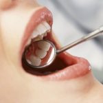 Inflamación sistémica causada por periodontitis