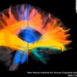 Estudian cambios en las conexiones neuronales postinfarto