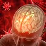 Las diferencias entre la neuromielitis óptica y la esclerosis múltiple