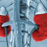 Enfermedad renal crónica y enfermedad cardiovascular, una relación peligrosa