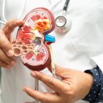 La dislipidemia es un factor de progresión de enfermedad renal crónica y cardiovascular