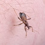 Medidas de reducción de riesgo para enfermedad de Chagas